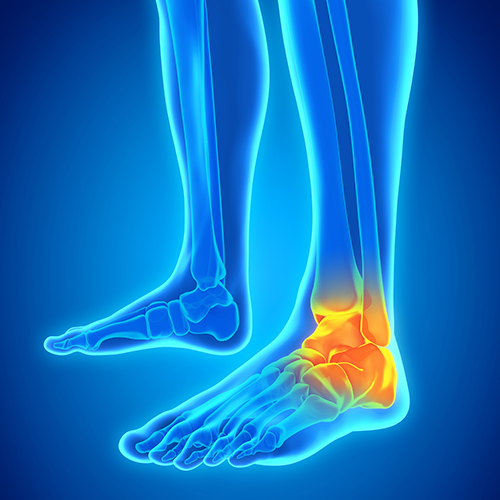 Foot & Ankle