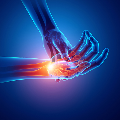 Hand, Wrist & Reconstructive Surgery
