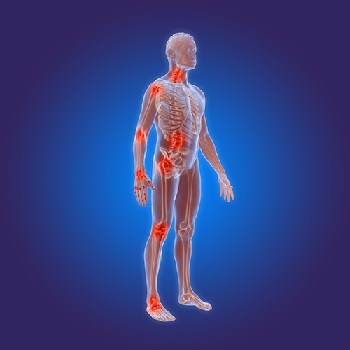Systemic Autoimmune Diseases