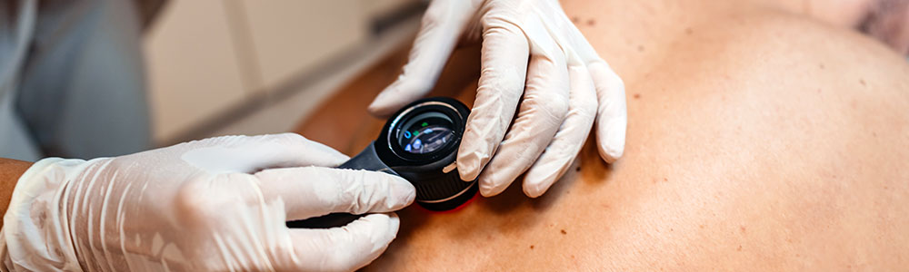 healthcare professional checking a patient's skin