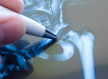 Bones & Joints